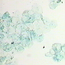 buccal smear at 100x