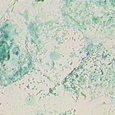 buccal smear at 400x