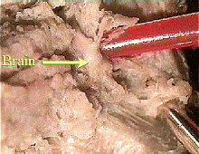 worm brain