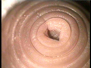 worm anus