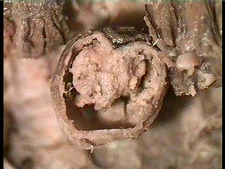 cross section of central tube