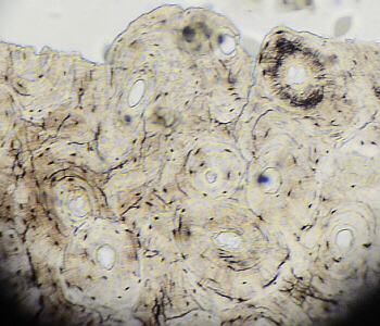 Microscopic View, Bone Cross Section