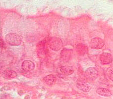 pseudostratified ciliated columnar epithelial cells
