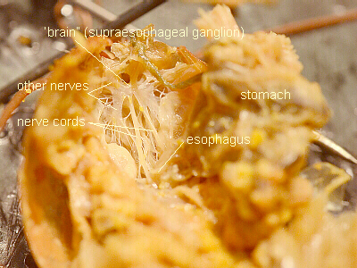 Labeled Nerve Cord and Brain