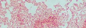 gram negative