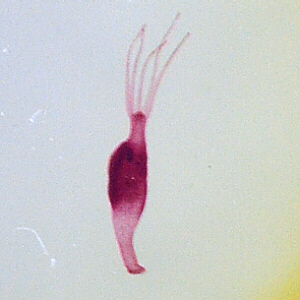 Hydra with ovaries