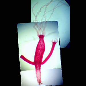 Hydra with buds
