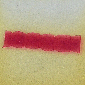 mature tapeworm segments