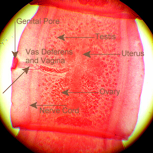 labeled tapeworm proglottid