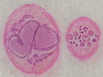 male and female