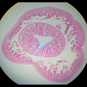 esophageal region