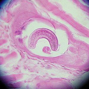 close-up of one cyst/worm