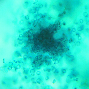 fern sperm around archegonia