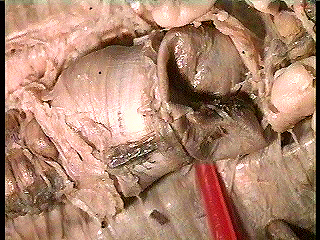 worm digestive tract